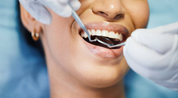 Best Emergency Dentist for Knocked-Out Tooth in Hampton Bays, NY